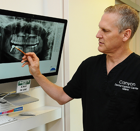 Digital Panoramic Dental X-Rays in North Vancouver