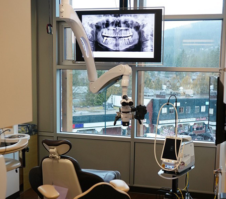 Digital Dental X-Rays in North Vancouver